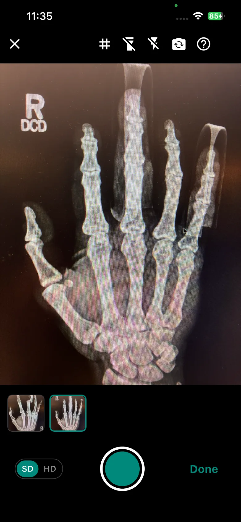 Capturing a clinical image inside EMMS, two already taken in the same session